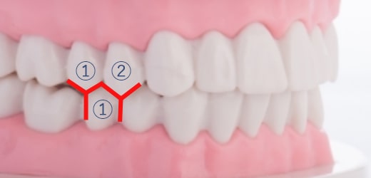 1歯対2歯の関係